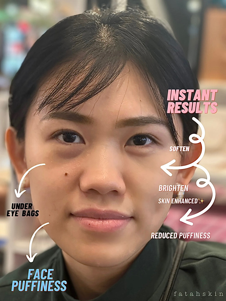 Instant Recovery Cream Mask - Face & Under eye Treatment