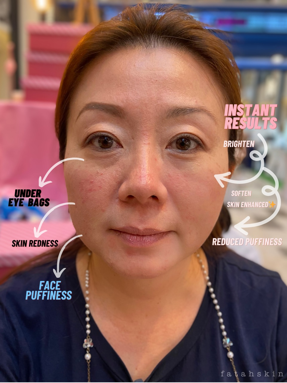 Instant Recovery Cream Mask - Face & Under eye Treatment