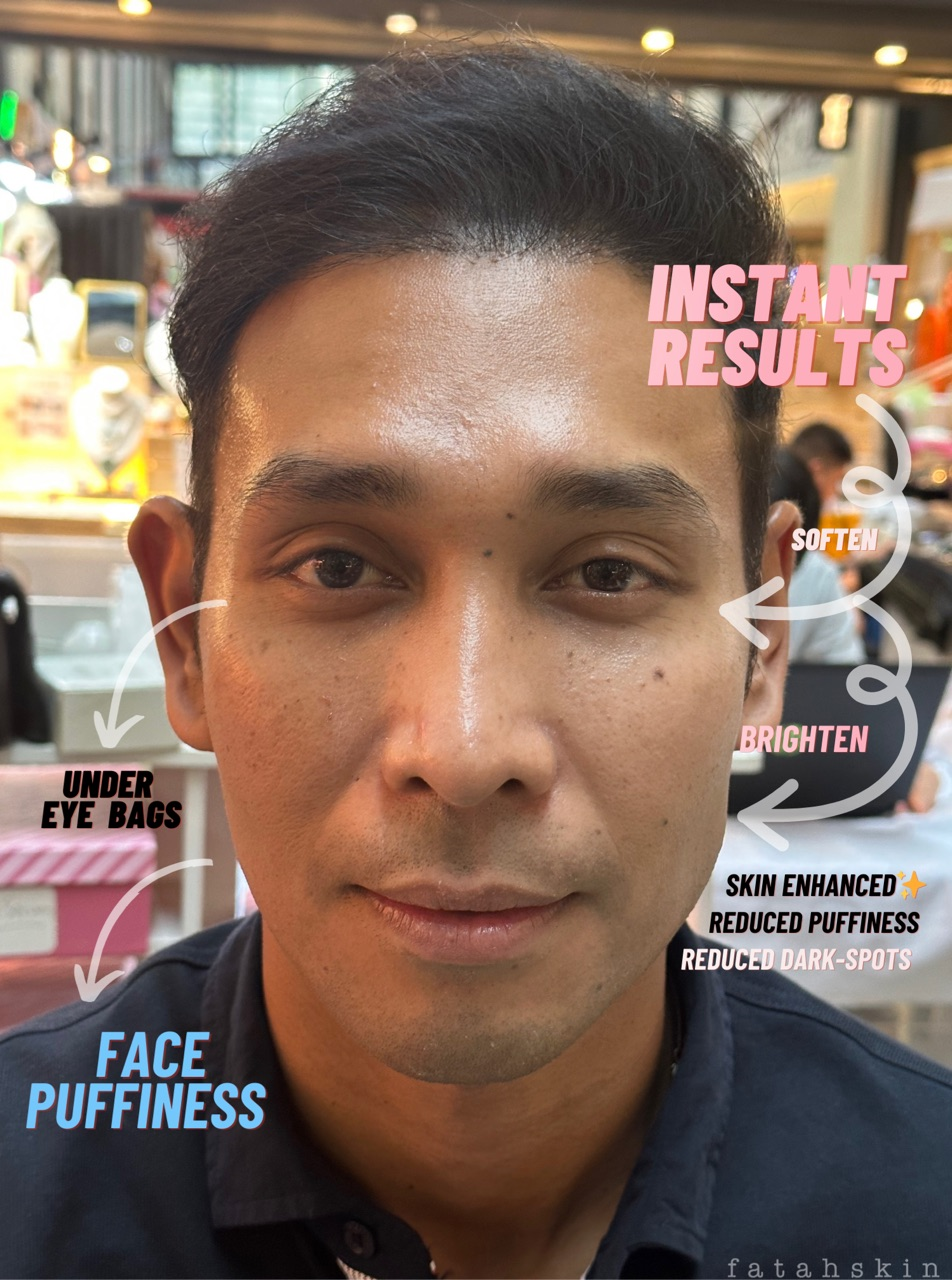 Instant Recovery Cream Mask - Face & Under eye Treatment