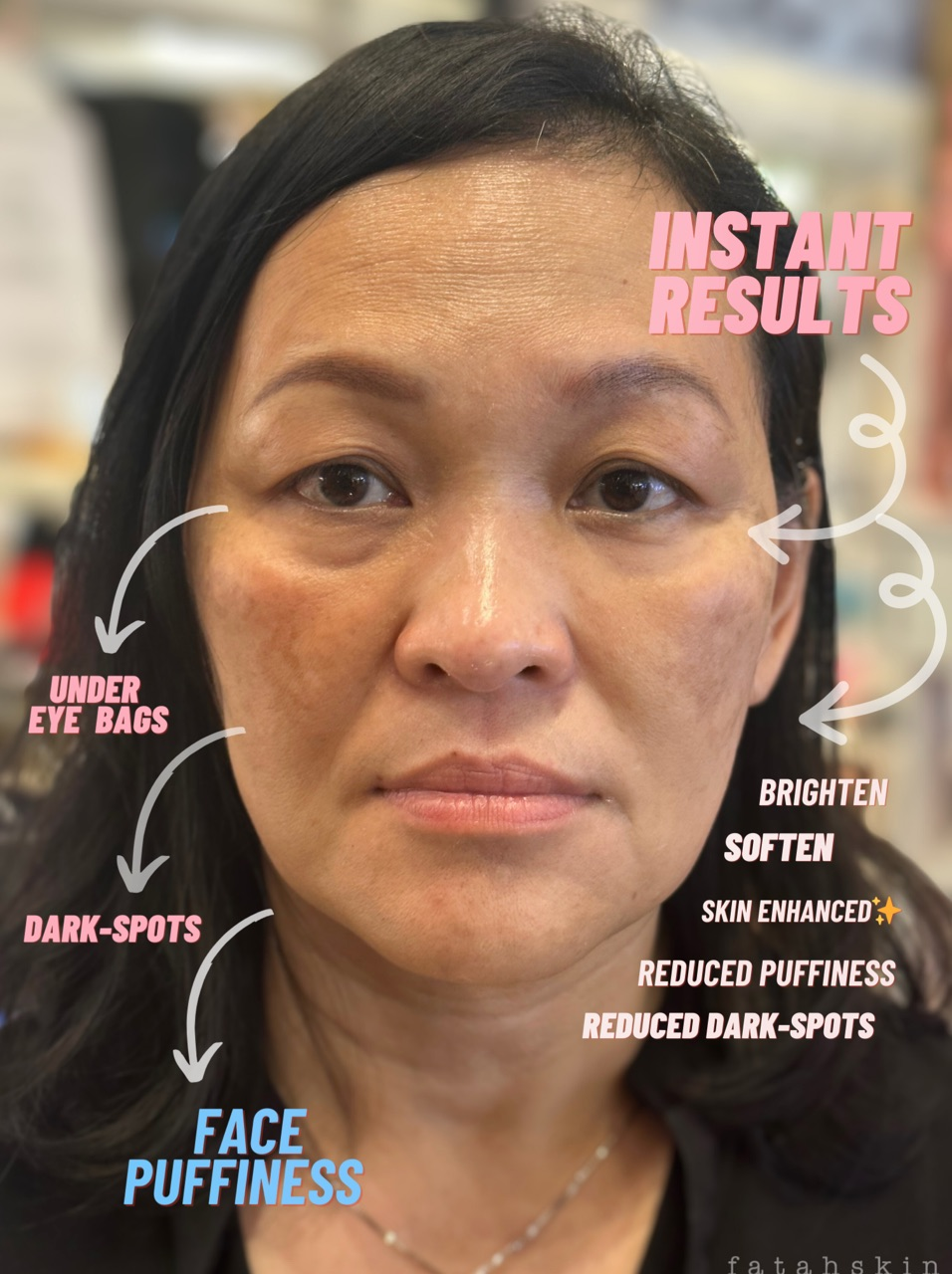 Instant Recovery Cream Mask - Face & Under eye Treatment