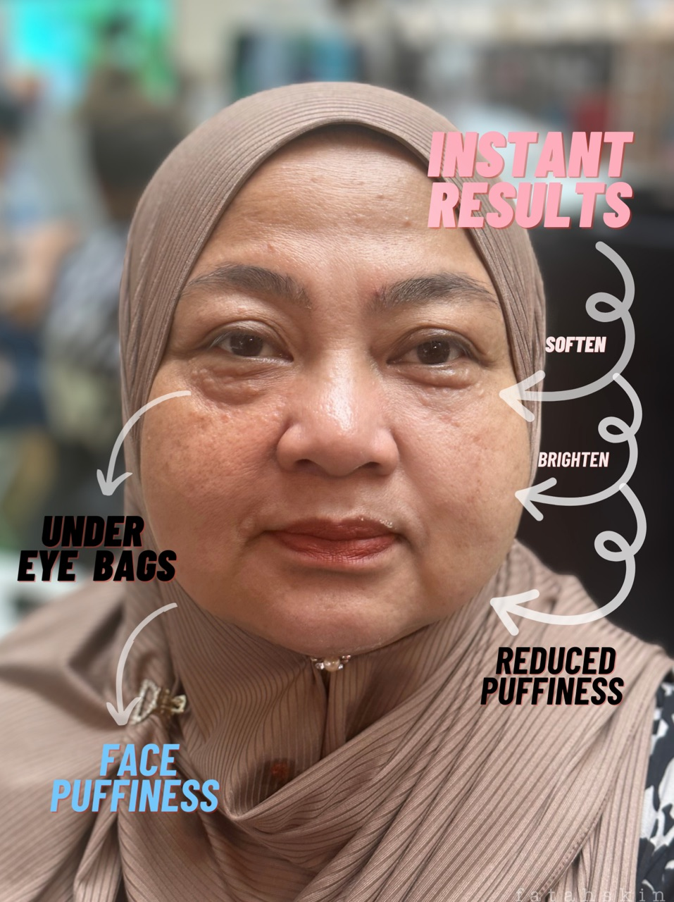 Instant Recovery Cream Mask - Face & Under eye Treatment