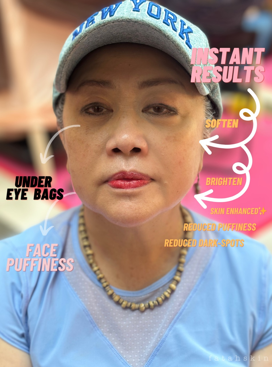 Instant Recovery Cream Mask - Face & Under eye Treatment