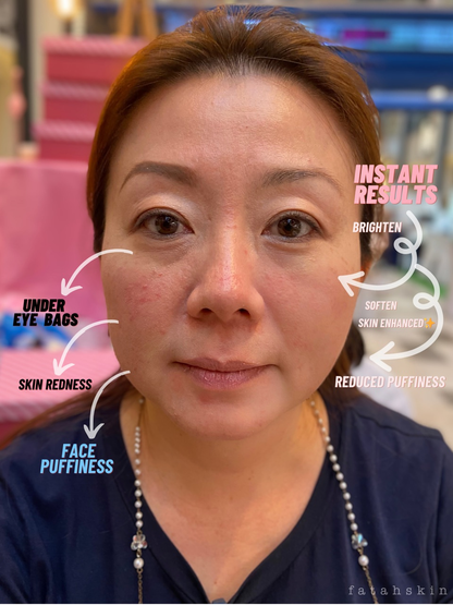 Instant Recovery Cream Mask - Face & Under eye Treatment
